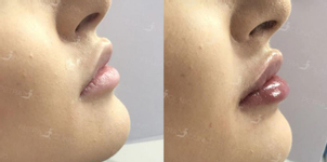 Klinika estetické medicíny Petra Clinic