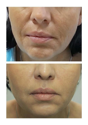 MUDr. Michaela Hustá