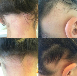 vypadávání vlasů