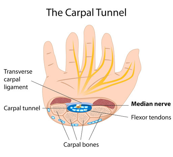 Příznaky karpálního tunelu