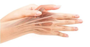 Pokud se problém neřeší, bolest může od zápěstí vystřelovat až k lokti