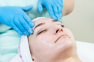 Aplikace chemického peelingu