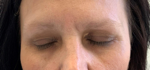 Doba rekonvalescence