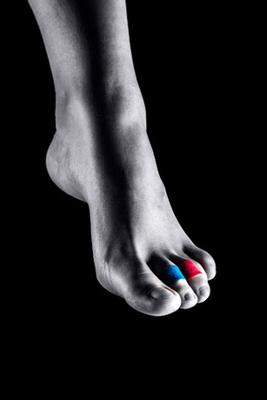 kladívkového prstu