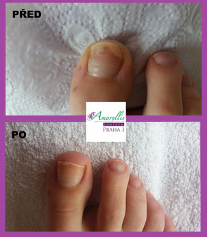 Amaryllis Centrum Praha