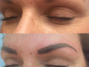 Mikropigmentace obočí