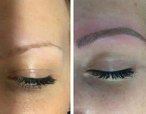 Mikropigmentace obočí