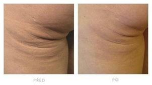 MUDr. Martin Molitor PhD.