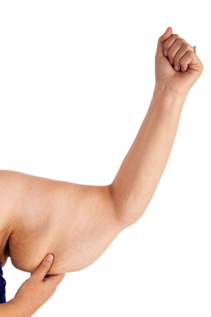 Jak probíhá zotavení po gastrickém bypassu?