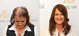 Klinika YES VISAGE - klinika estetické medicíny a plastické chirurgie