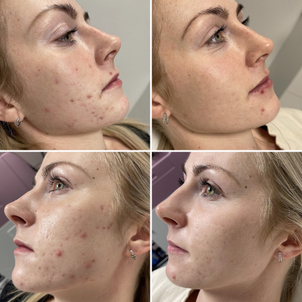 Fotografie před a po