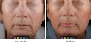 Laserová dermatologická klinika ALTOS