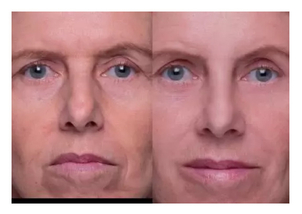 Proměna se uskutečnila ve spolupráci s časopisem Health&Beauty. Zdroj fotografií: Jaroslav Fikota / Health&Beauty.