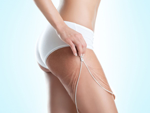 Typy metody odstranění strií