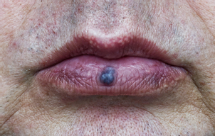 Jak se připravit na zákrok?