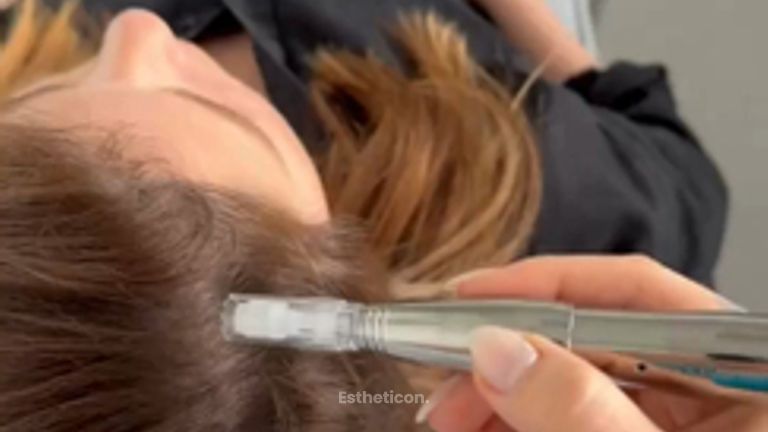 Estheticon_Vlasový microneedling