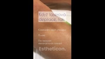 Laserová epilace - Klinika Laser Esthetic