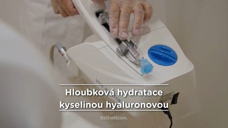 Jak probíhá hloubková hydratace kyselinou hyaluronovou?
