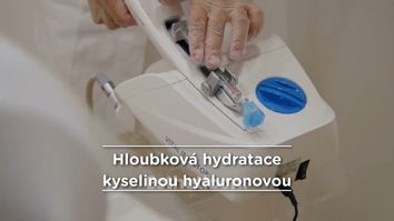 Jak probíhá hloubková hydratace kyselinou hyaluronovou?