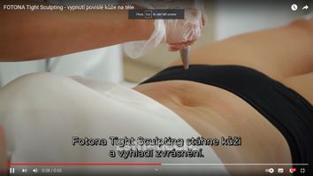 FOTONA Tight Sculpting - vypnutí povislé kůže na těle