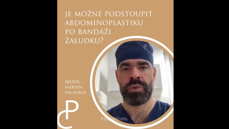 Abdominoplastika - MUDr. Martin Paciorek
