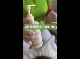 Chemický peeling