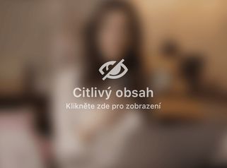 Plastická operace horních víček  - příběh pacientky - MUDr. Jiří Štern, Oculista oční centrum