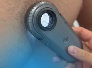 Vyšetření znamének