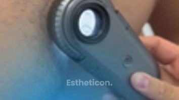 Vyšetření znamének