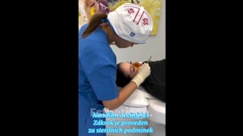 Nechirurgická korekce nosu - Rajská Clinic