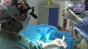 Přenos tuku na klinice Aestea