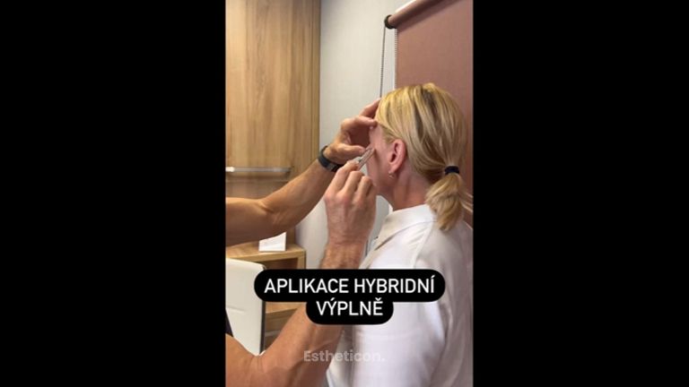 Kyselina hyaluronová - Perfect Clinic - centrum estetické medicíny