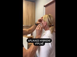 Kyselina hyaluronová - Perfect Clinic - centrum estetické medicíny