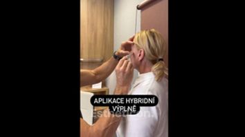 Kyselina hyaluronová - Perfect Clinic - centrum estetické medicíny