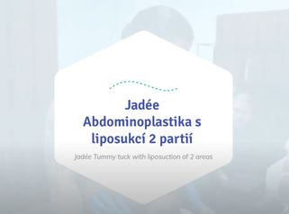 Jadée - Tummy tuck with liposuction of 2 areas