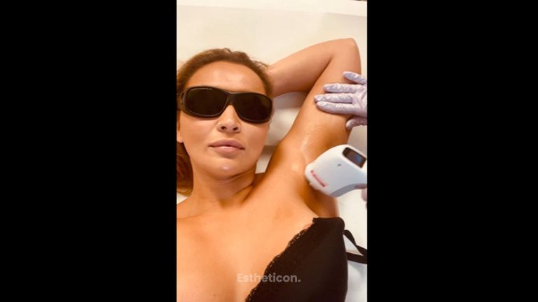 Laserová epilace - Neo Beauty Clinic