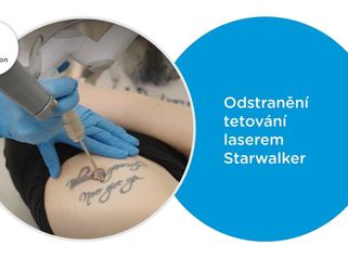 Odstranění tetování laserem Starwalker - Petra Weber