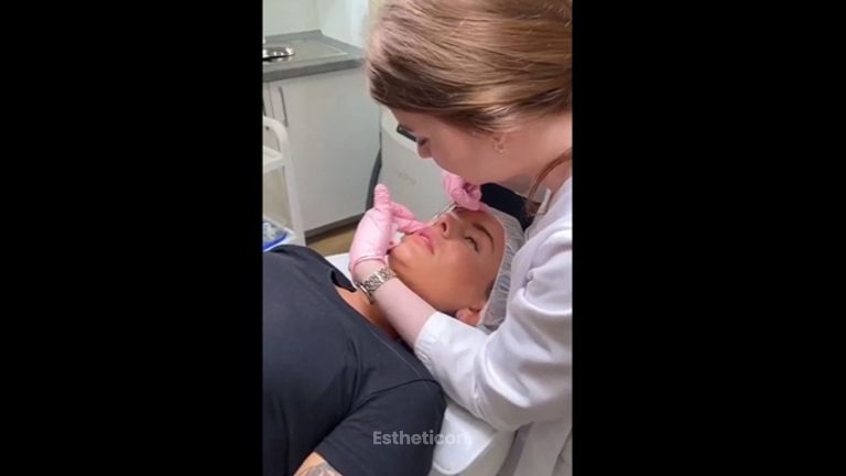 Zvětšení rtů kyselinou hyaluronovou - MUDr. Elizabeth (Adenubiová) Pavlíčková, PhD.
