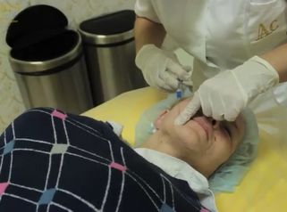 Aplikace hyaluronové kyseliny - plastická a estetická medicína AURUM AESTHETIC CLINIC