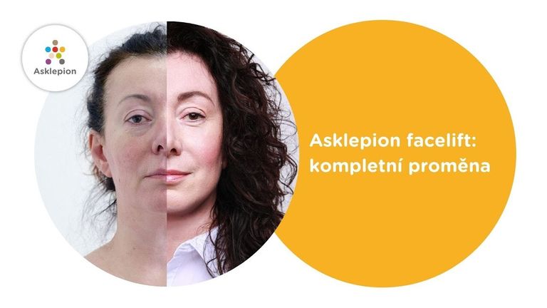 Kompletní proměna Asklepion facelift v lokální anestezii