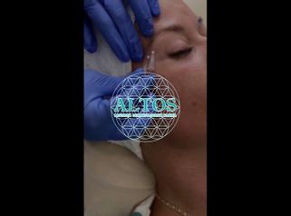 Mezoterapie - Laserová Dermatologická Klinika ALTOS