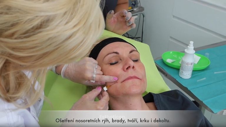 Aplikace kyseliny hyaluronové