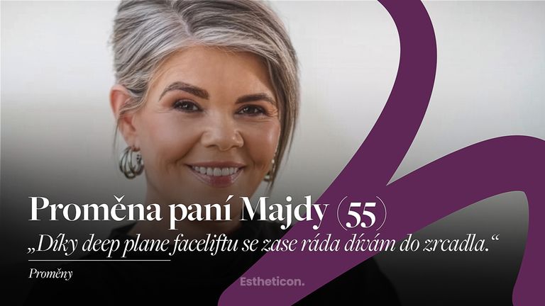 Plastická operace obličeje proměna - MUDr Petros Christodoulou