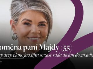 Plastická operace obličeje proměna - MUDr Petros Christodoulou