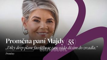 Plastická operace obličeje proměna - MUDr Petros Christodoulou