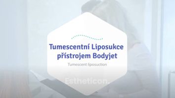 Tumescentní liposukce přístrojem Body-Jet - Nejčastější otázky!