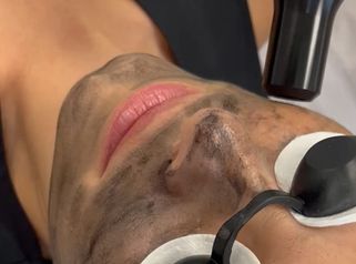Hollywood Peel