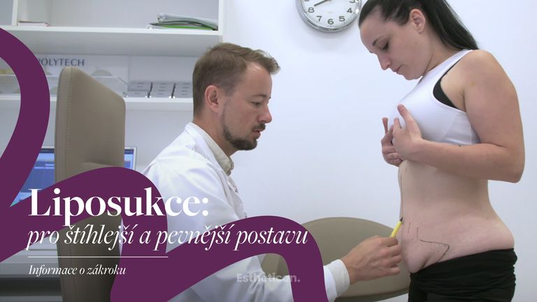 O liposukci - MUDr. Petr Pachman