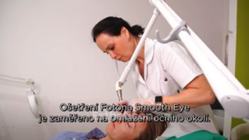 FOTONA SMOOTH EYE - omlazení očního okolí